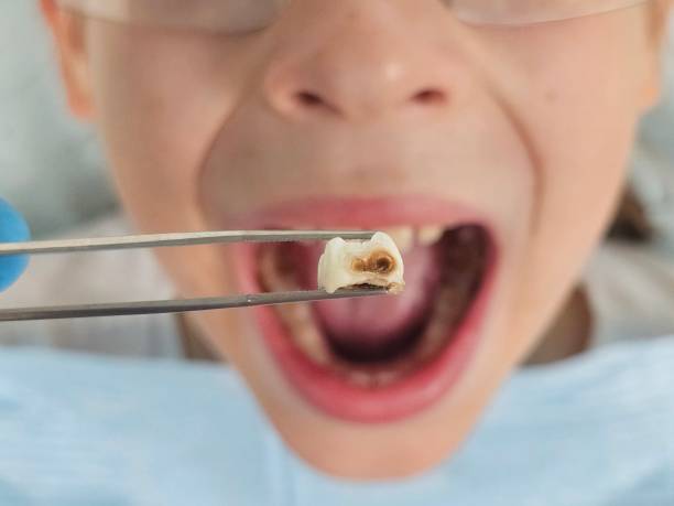 Best Emergency Denture Repair in Corinth, MS
