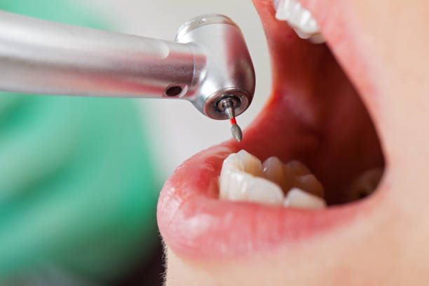 Best Emergency Dental Care for Broken or Chipped Teeth in Corinth, MS